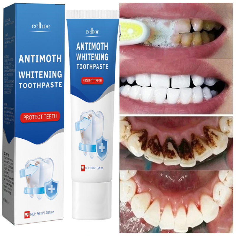 Teeth Whitening Fast - Remoção rápida de manchas de fumaça,