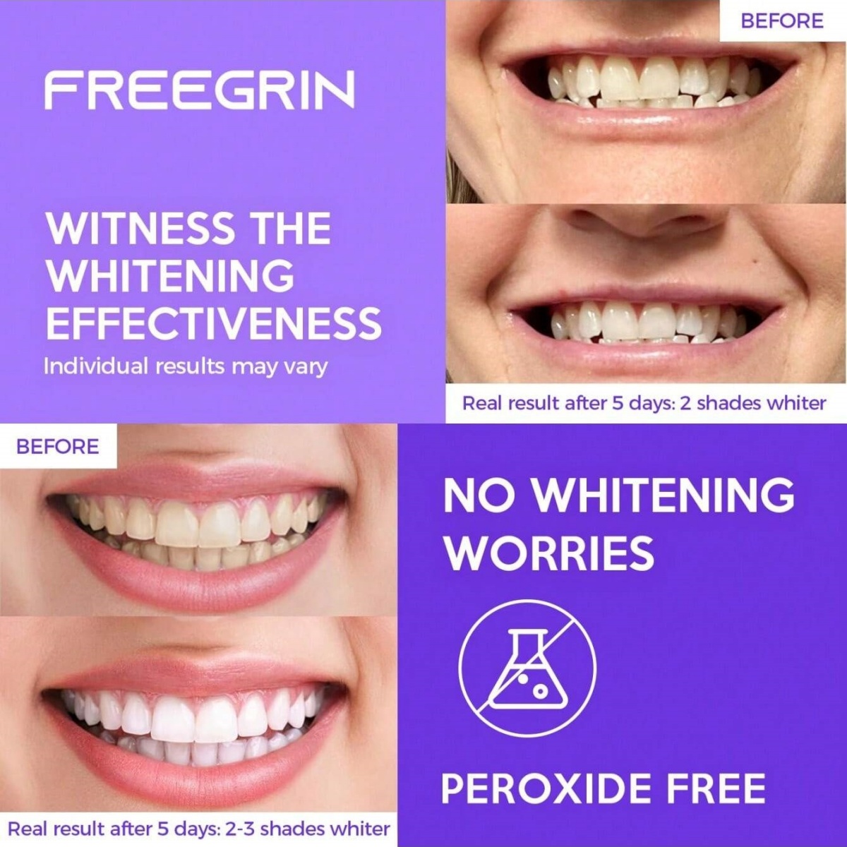 Adesivos de clareamento dental - Teeth Whitening Q&M avaliação e preço