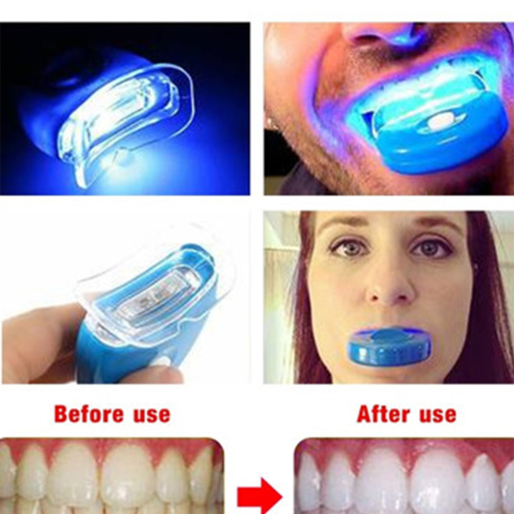 Acelerador de clareamento dent - Teeth Whitening Laser avaliação e preço