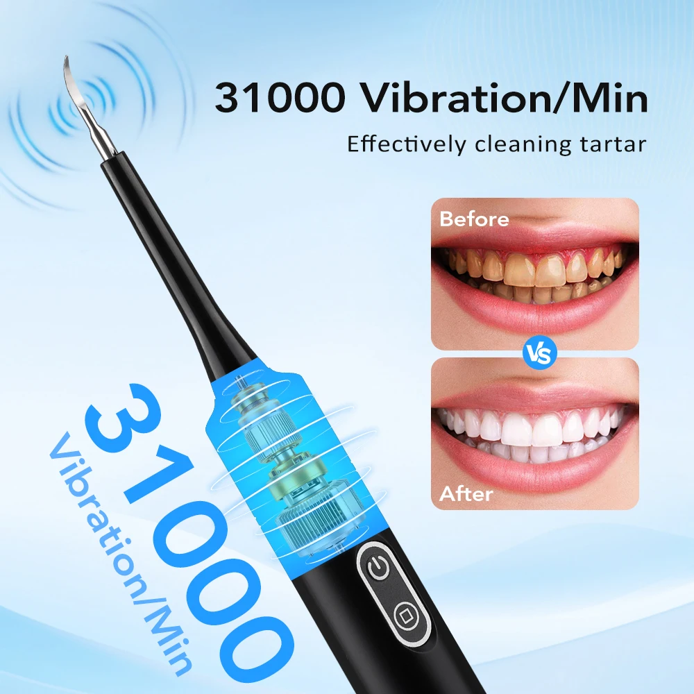 Escova de Dentes Elétrica com  - Whitening Teeth Dentist avaliação e preço